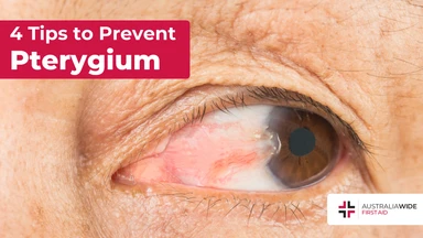 Prevent pterygium article header – First Aid Article in Box Hill